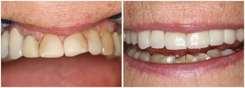 before_after5-md