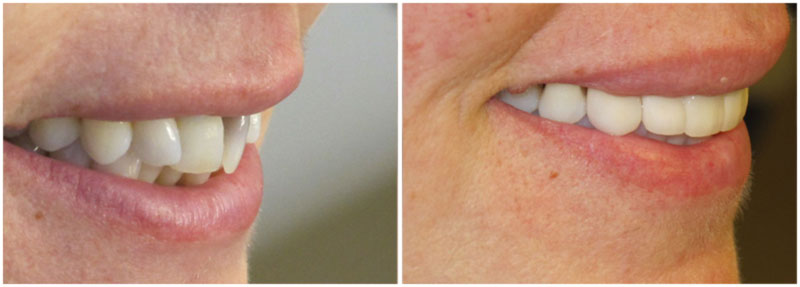 before_after6-md