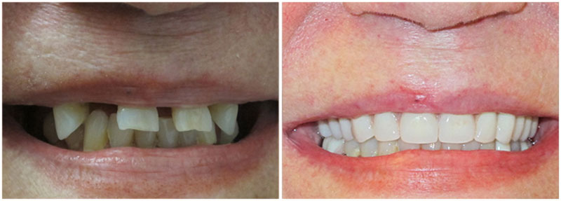 before_after7-md